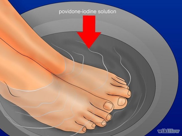 soaking ingrown toenail