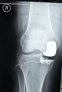 t_2013-12-01 07.09.30