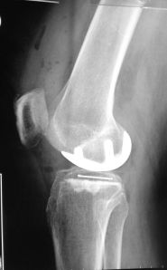 t_2013-12-01 07.09.39