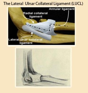 elbow-ligament-reconstruction-1 (1)