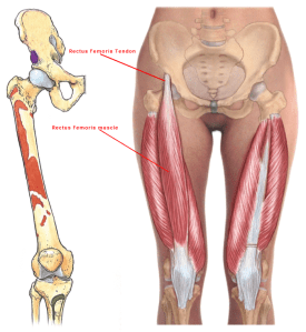 00.6 - Rectus-femoris-tendon