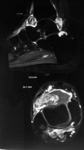 2015-08-22 06.38.27-1